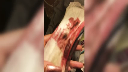 Смена прокладки